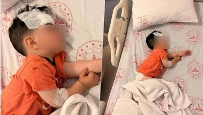 Şanlıurfa'da k&uuml;&ccedil;&uuml;k &ccedil;ocuğu yaralayan k&ouml;pek saldırısına idari soruşturma